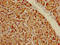 Dual Specificity Tyrosine Phosphorylation Regulated Kinase 3 antibody, LS-C396346, Lifespan Biosciences, Immunohistochemistry paraffin image 