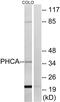 Alkaline Ceramidase 3 antibody, GTX87351, GeneTex, Western Blot image 