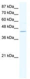 Zinc Finger Protein 212 antibody, TA333881, Origene, Western Blot image 