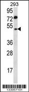 Abhydrolase Domain Containing 2 antibody, 56-842, ProSci, Western Blot image 