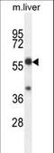TBCC Domain Containing 1 antibody, LS-C161739, Lifespan Biosciences, Western Blot image 