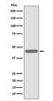 AlkB Homolog 1, Histone H2A Dioxygenase antibody, M06945-1, Boster Biological Technology, Western Blot image 