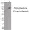 RB Transcriptional Corepressor 1 antibody, 79-834, ProSci, Western Blot image 