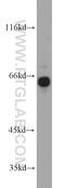 Growth Factor Receptor Bound Protein 7 antibody, 10045-1-Ig, Proteintech Group, Western Blot image 