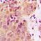Breast cancer type 2 susceptibility protein homolog antibody, orb216037, Biorbyt, Immunohistochemistry paraffin image 
