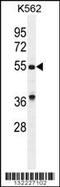 Growth Differentiation Factor 9 antibody, 56-264, ProSci, Western Blot image 