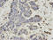 Proteasome 26S Subunit, Non-ATPase 7 antibody, A09527, Boster Biological Technology, Immunohistochemistry frozen image 