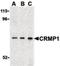 Collapsin Response Mediator Protein 1 antibody, orb86718, Biorbyt, Western Blot image 