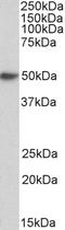 Musashi RNA Binding Protein 2 antibody, 43-615, ProSci, Western Blot image 