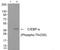 CCAAT Enhancer Binding Protein Alpha antibody, AP55806PU-S, Origene, Western Blot image 