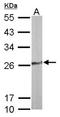 Thiamin pyrophosphokinase 1 antibody, NBP1-32248, Novus Biologicals, Western Blot image 