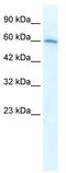 Cholinergic Receptor Nicotinic Alpha 7 Subunit antibody, TA338736, Origene, Western Blot image 