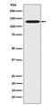 Coiled-Coil And C2 Domain Containing 1A antibody, M04775, Boster Biological Technology, Western Blot image 