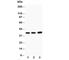 TNF Alpha Induced Protein 1 antibody, R30362, NSJ Bioreagents, Western Blot image 