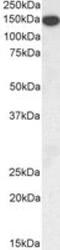 Thrombospondin 1 antibody, NBP2-42522, Novus Biologicals, Western Blot image 