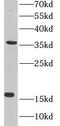 Mediator Complex Subunit 10 antibody, FNab05086, FineTest, Western Blot image 