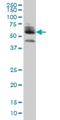 Zinc Finger Protein 345 antibody, H00025850-M01, Novus Biologicals, Western Blot image 