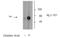Tyrosine Hydroxylase antibody, GTX31133, GeneTex, Western Blot image 
