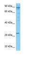 Leucine Rich Repeat Containing 52 antibody, orb325159, Biorbyt, Western Blot image 