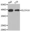 Elongation of very long chain fatty acids protein 6 antibody, abx002510, Abbexa, Western Blot image 