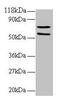 Succinate Dehydrogenase Complex Flavoprotein Subunit A antibody, CSB-PA01985A0Rb, Cusabio, Western Blot image 