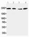 Reticulon 4 antibody, PA1060, Boster Biological Technology, Western Blot image 