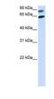 Dishevelled Segment Polarity Protein 2 antibody, NBP1-58849, Novus Biologicals, Western Blot image 