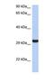 Granzyme K antibody, NBP1-69548, Novus Biologicals, Western Blot image 