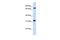 T-Complex 10 antibody, GTX46211, GeneTex, Western Blot image 