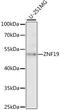 Zinc Finger Protein 19 antibody, LS-C750298, Lifespan Biosciences, Western Blot image 