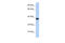 DMRT Like Family C2 antibody, 25-320, ProSci, Enzyme Linked Immunosorbent Assay image 