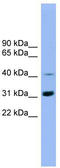 IQ Motif Containing D antibody, TA340296, Origene, Western Blot image 