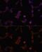 Lysosomal Associated Membrane Protein 1 antibody, GTX33293, GeneTex, Immunocytochemistry image 