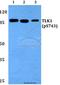 Tousled Like Kinase 1 antibody, A05635S743, Boster Biological Technology, Western Blot image 