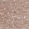 Ryanodine Receptor 2 antibody, NBP1-90091, Novus Biologicals, Immunohistochemistry paraffin image 