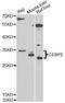 CCAAT Enhancer Binding Protein Epsilon antibody, LS-C748975, Lifespan Biosciences, Western Blot image 