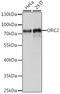 Origin Recognition Complex Subunit 2 antibody, A15697, ABclonal Technology, Western Blot image 