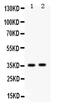 FosB Proto-Oncogene, AP-1 Transcription Factor Subunit antibody, PA5-79280, Invitrogen Antibodies, Western Blot image 