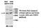 Importin-4 antibody, MBS415517, MyBioSource, Western Blot image 