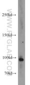 Tubulin Gamma Complex Associated Protein 3 antibody, 15719-1-AP, Proteintech Group, Western Blot image 