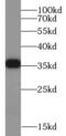 Interleukin 20 Receptor Subunit Beta antibody, FNab04250, FineTest, Western Blot image 