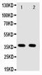 Annexin A10 antibody, PA2077, Boster Biological Technology, Western Blot image 