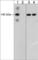 Cadherin 5 antibody, CP1981, ECM Biosciences, Western Blot image 