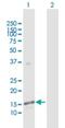 Polypeptide N-Acetylgalactosaminyltransferase 3 antibody, H00002591-D01P, Novus Biologicals, Western Blot image 