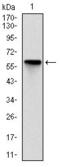 Rho Associated Coiled-Coil Containing Protein Kinase 1 antibody, GTX60535, GeneTex, Western Blot image 