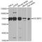 Insulin Like Growth Factor 2 MRNA Binding Protein 2 antibody, A14103, ABclonal Technology, Western Blot image 