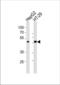 SMAD Family Member 6 antibody, TA324805, Origene, Western Blot image 