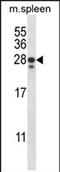 Ankyrin Repeat Domain 22 antibody, PA5-71839, Invitrogen Antibodies, Western Blot image 