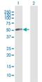 Vacuolar Protein Sorting 4 Homolog A antibody, H00027183-B01P, Novus Biologicals, Western Blot image 