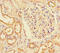 E3 ubiquitin-protein ligase MIB1 antibody, A54177-100, Epigentek, Immunohistochemistry paraffin image 